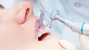 Imágenes de servicio de Odontología Arguello 7