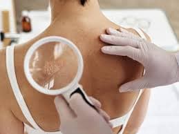 Imágenes de servicio de Dermatológo 1